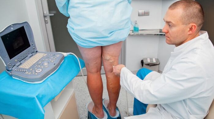 Diagnóstico de varices